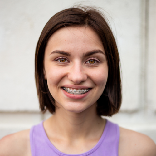 Jovem sorrindo com aparelho ortodôntico metálico nos dentes, representando os resultados do tratamento de alinhamento dental.