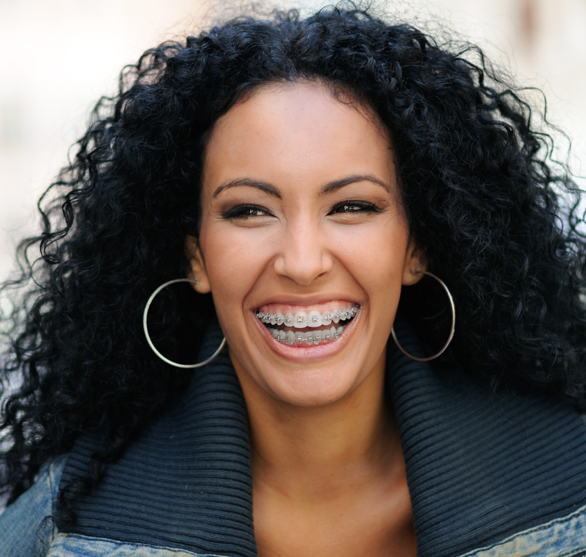 Mulher sorrindo com aparelho ortodôntico, demonstrando os resultados do alinhamento dental e tratamento estético