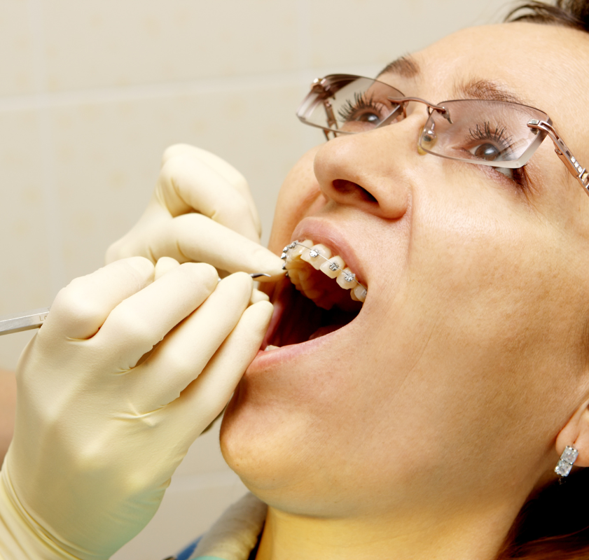 Paciente sendo examinada por dentista durante consulta ortodôntica para manutenção de aparelho dental
